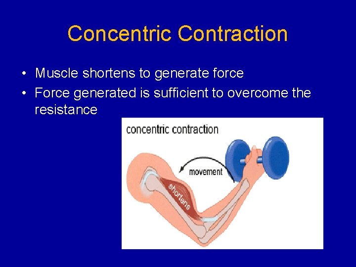 Concentric Contraction • Muscle shortens to generate force • Force generated is sufficient to