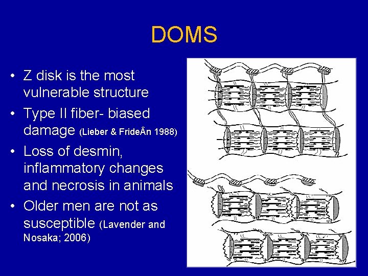 DOMS • Z disk is the most vulnerable structure • Type II fiber- biased