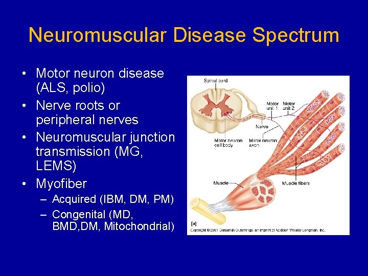 Neuromuscular Disease Spectrum • Motor neuron disease (ALS, polio) • Nerve roots or peripheral