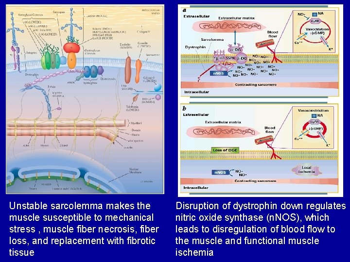 Unstable sarcolemma makes the muscle susceptible to mechanical stress , muscle fiber necrosis, fiber