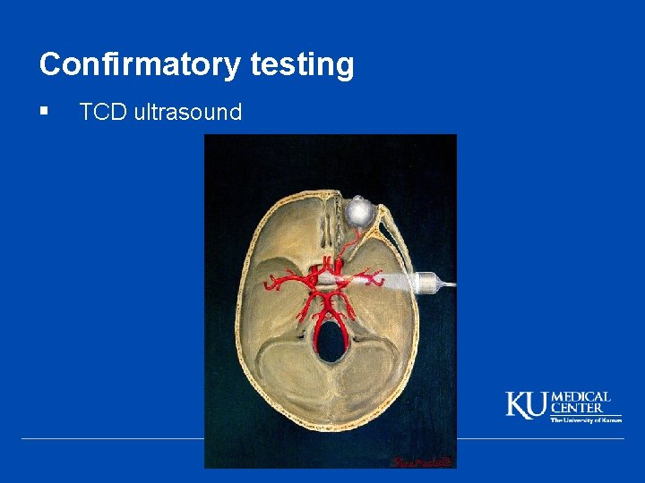 Confirmatory testing § TCD ultrasound 