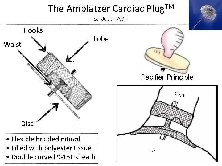 The Amplatzer Cardiac Plug. TM St. Jude - AGA Hooks Waist Lobe Pacifier Principle