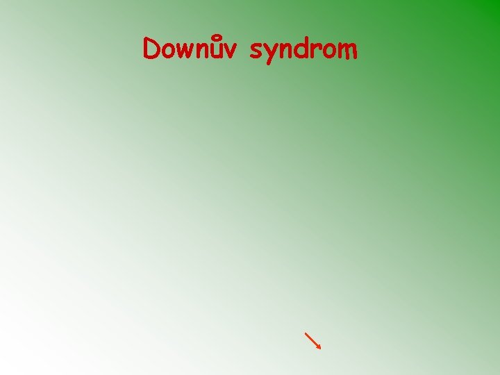 Downův syndrom 