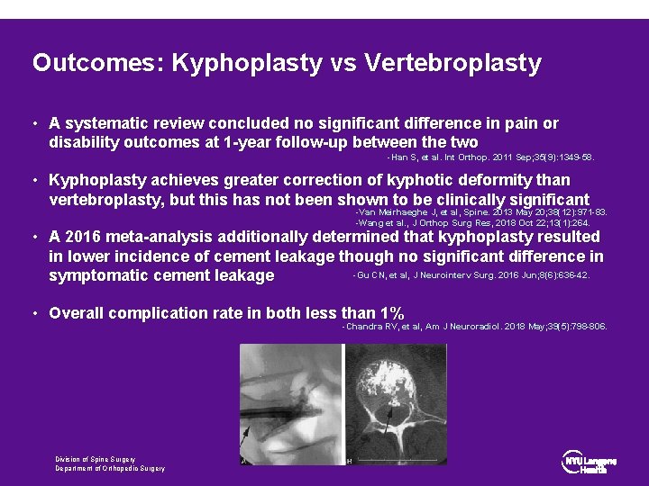 Outcomes: Kyphoplasty vs Vertebroplasty • A systematic review concluded no significant difference in pain