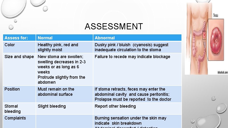 ASSESSMENT Assess for: Normal Abnormal Color Healthy pink, red and slightly moist Dusky pink