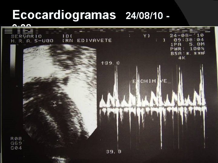 Ecocardiogramas 9: 38 24/08/10 - 