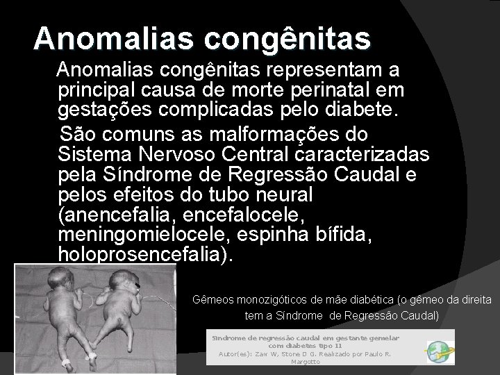 Anomalias congênitas representam a principal causa de morte perinatal em gestações complicadas pelo diabete.