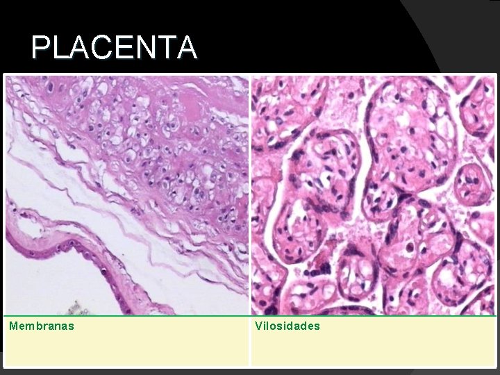 PLACENTA Membranas Vilosidades 