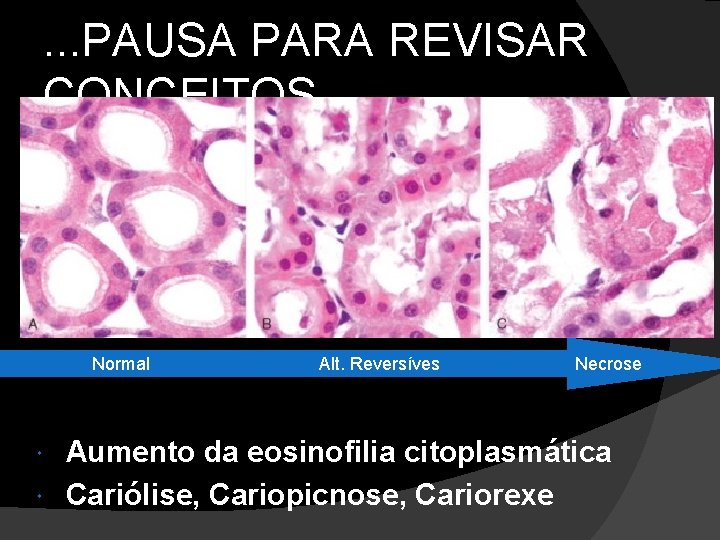 . . . PAUSA PARA REVISAR CONCEITOS Normal Alt. Reversíves Necrose Aumento da eosinofilia