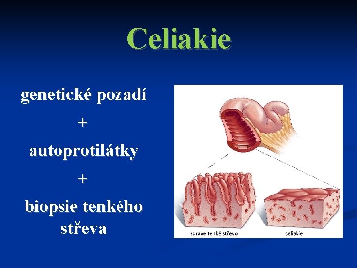 Celiakie genetické pozadí + autoprotilátky + biopsie tenkého střeva 