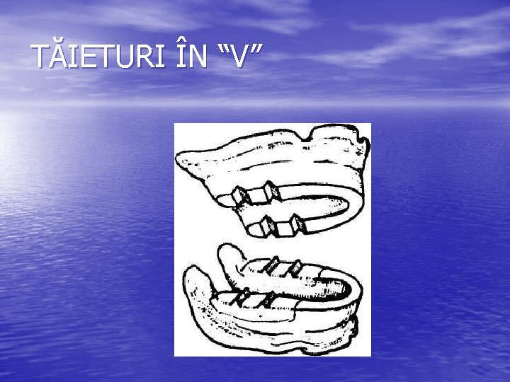 TĂIETURI ÎN “V” TĂIETURI ÎN “V”