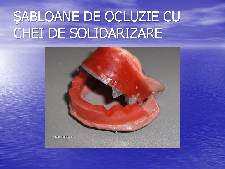 ŞABLOANE DE OCLUZIE CU CHEI DE SOLIDARIZARE ŞABLOANE DE OCLUZIE CU CHEI DE SOLIDARIZARE
