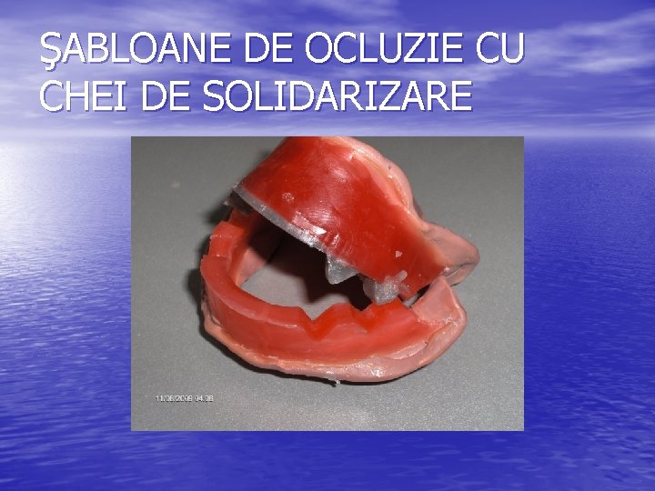 ŞABLOANE DE OCLUZIE CU CHEI DE SOLIDARIZARE 