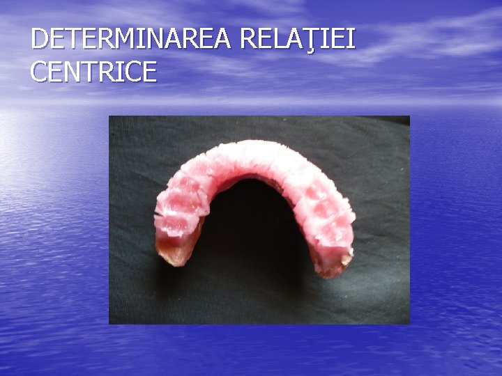 DETERMINAREA RELAŢIEI CENTRICE DETERMINAREA RELAŢIEI CENTRICE