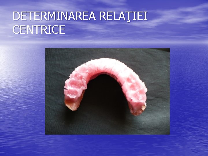 DETERMINAREA RELAŢIEI CENTRICE 