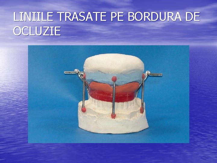 LINIILE TRASATE PE BORDURA DE OCLUZIE LINIILE TRASATE PE BORDURA DE OCLUZIE