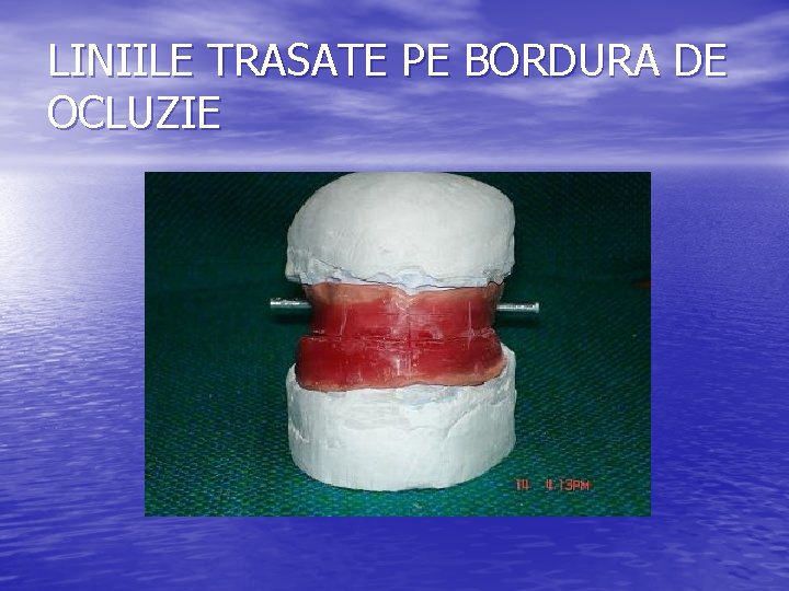 LINIILE TRASATE PE BORDURA DE OCLUZIE LINIILE TRASATE PE BORDURA DE OCLUZIE