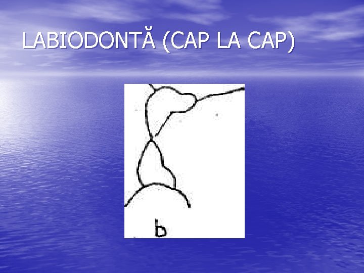 LABIODONTĂ (CAP LA CAP) LABIODONTĂ (CAP LA CAP)