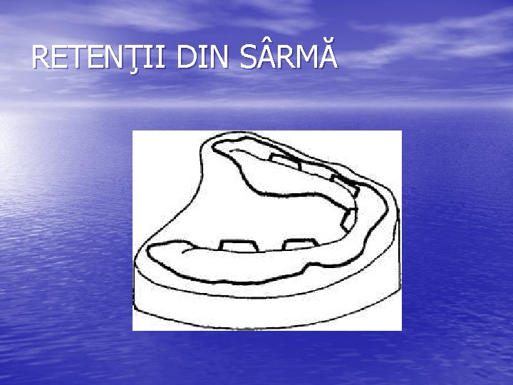 RETENŢII DIN S RMĂ RETENŢII DIN S RMĂ