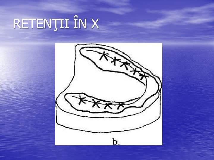 RETENŢII ÎN X RETENŢII ÎN X