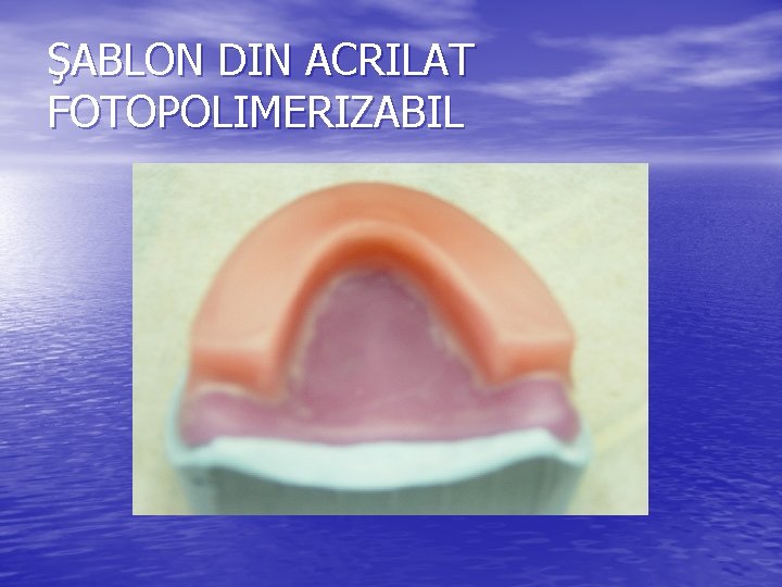 ŞABLON DIN ACRILAT FOTOPOLIMERIZABIL ŞABLON DIN ACRILAT FOTOPOLIMERIZABIL