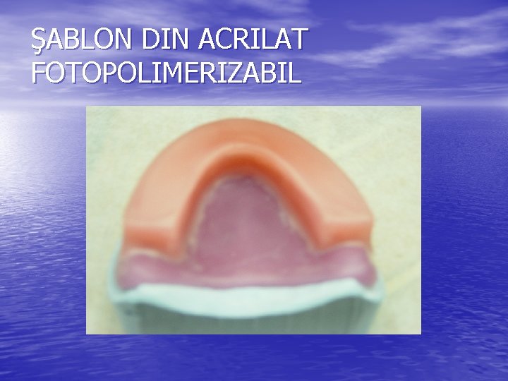 ŞABLON DIN ACRILAT FOTOPOLIMERIZABIL 