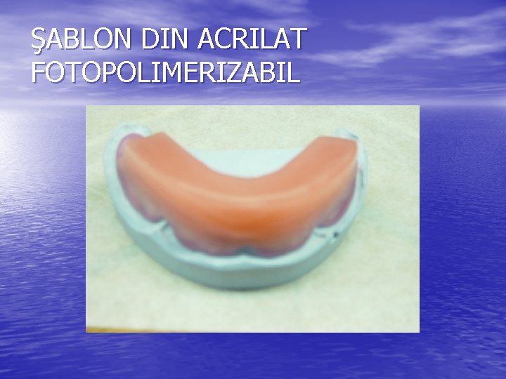 ŞABLON DIN ACRILAT FOTOPOLIMERIZABIL ŞABLON DIN ACRILAT FOTOPOLIMERIZABIL
