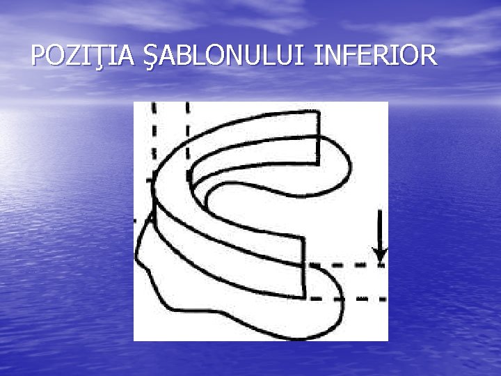 POZIŢIA ŞABLONULUI INFERIOR POZIŢIA ŞABLONULUI INFERIOR