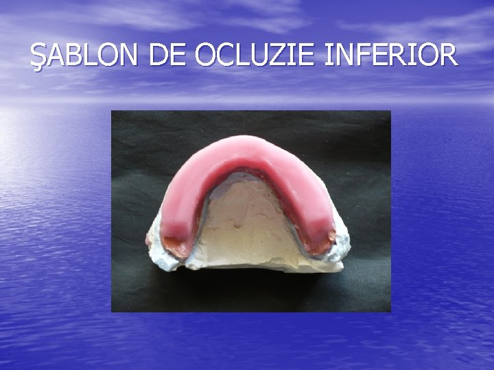 ŞABLON DE OCLUZIE INFERIOR ŞABLON DE OCLUZIE INFERIOR