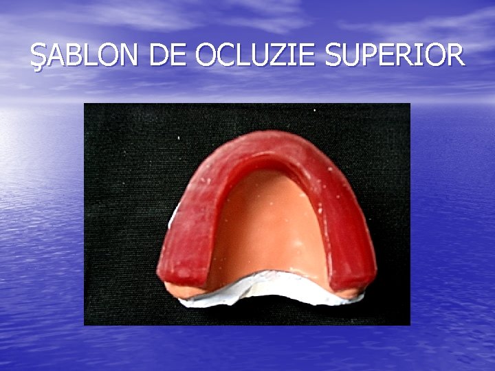 ŞABLON DE OCLUZIE SUPERIOR ŞABLON DE OCLUZIE SUPERIOR