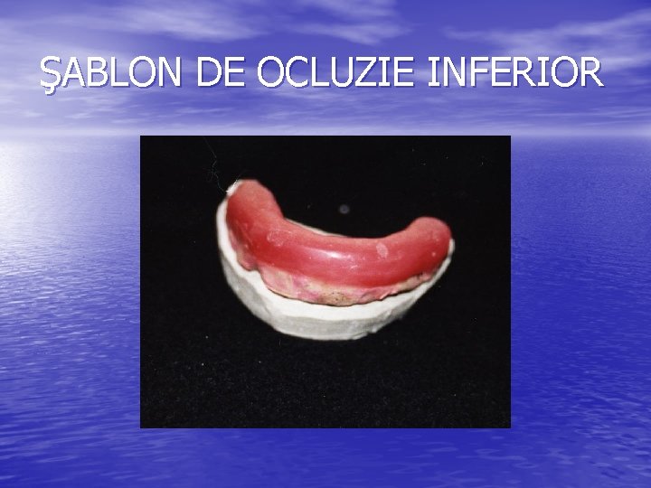 ŞABLON DE OCLUZIE INFERIOR ŞABLON DE OCLUZIE INFERIOR