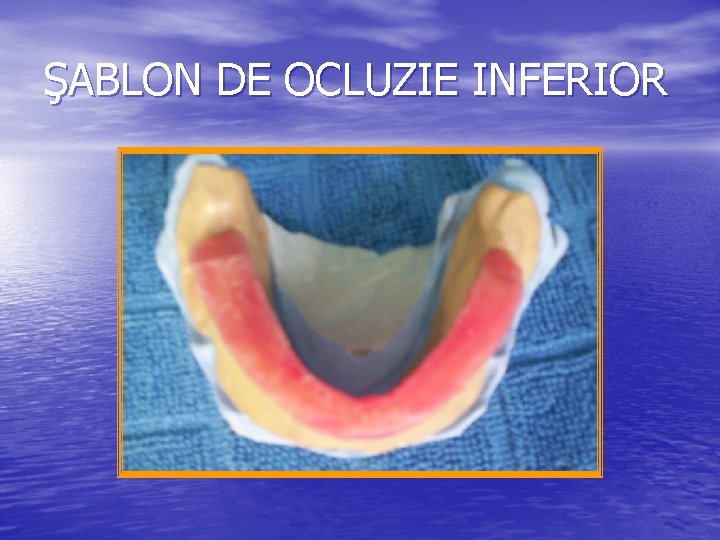 ŞABLON DE OCLUZIE INFERIOR ŞABLON DE OCLUZIE INFERIOR