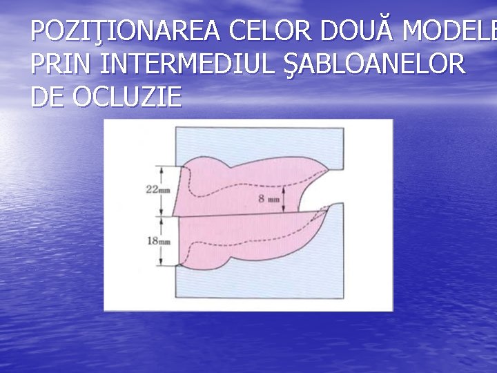 POZIŢIONAREA CELOR DOUĂ MODELE PRIN INTERMEDIUL ŞABLOANELOR DE OCLUZIE POZIŢIONAREA CELOR DOUĂ MODELE PRIN INTERMEDIUL ŞABLOANELOR DE OCLUZIE