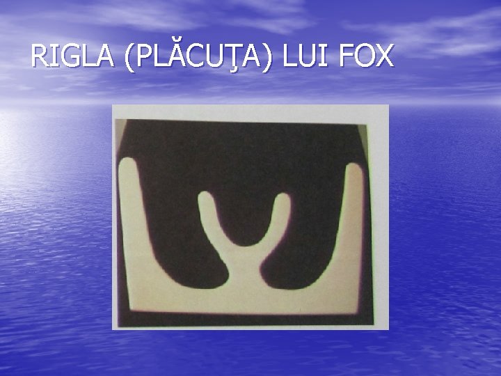 RIGLA (PLĂCUŢA) LUI FOX 