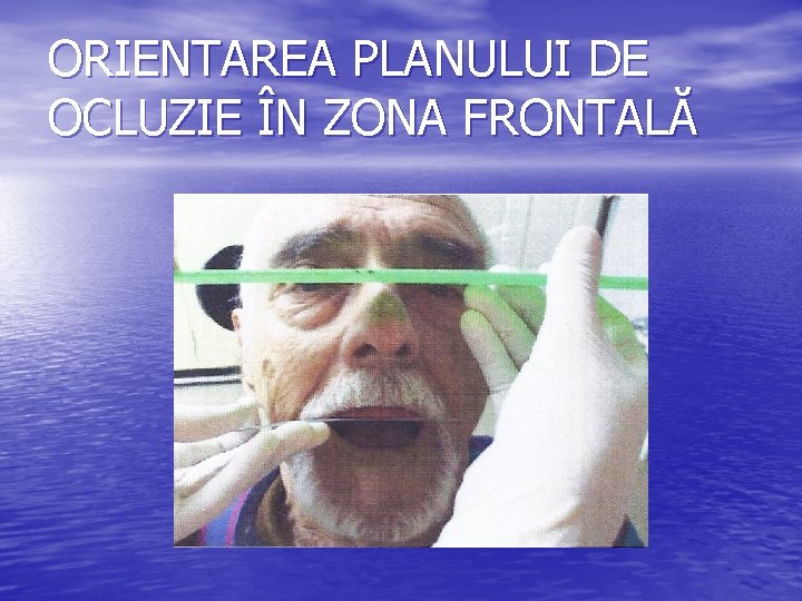 ORIENTAREA PLANULUI DE OCLUZIE ÎN ZONA FRONTALĂ ORIENTAREA PLANULUI DE OCLUZIE ÎN ZONA FRONTALĂ
