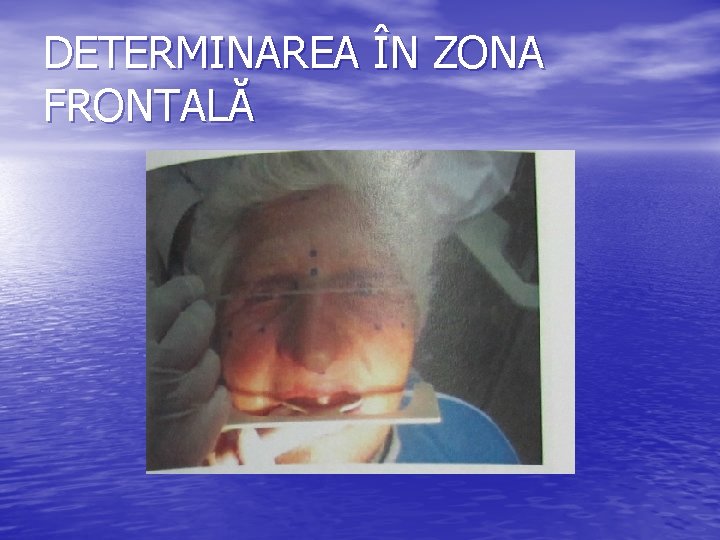 DETERMINAREA ÎN ZONA FRONTALĂ DETERMINAREA ÎN ZONA FRONTALĂ