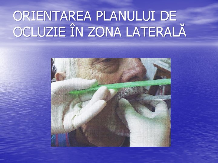 ORIENTAREA PLANULUI DE OCLUZIE ÎN ZONA LATERALĂ 