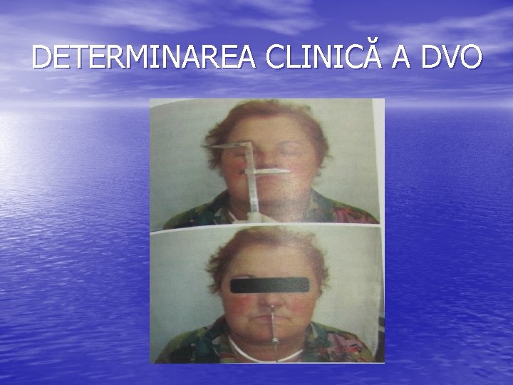 DETERMINAREA CLINICĂ A DVO 