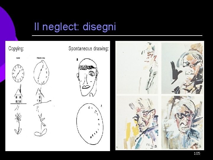 Il neglect: disegni 105 