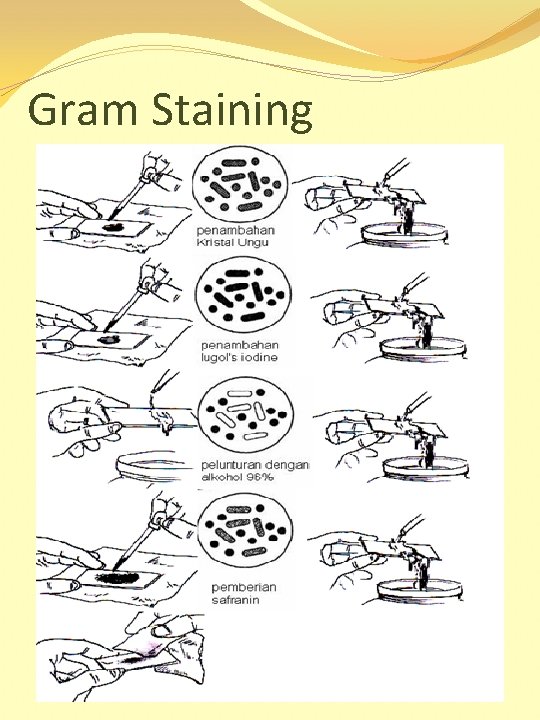 Gram Staining 