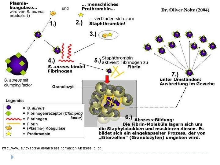 http: //www. autovaccine. de/abscess_formation/Abszess_b. jpg 