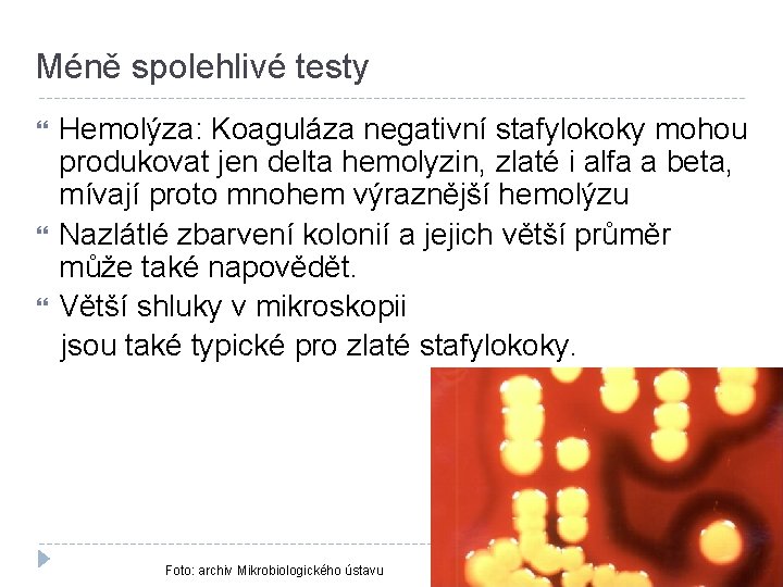 Méně spolehlivé testy Hemolýza: Koaguláza negativní stafylokoky mohou produkovat jen delta hemolyzin, zlaté i