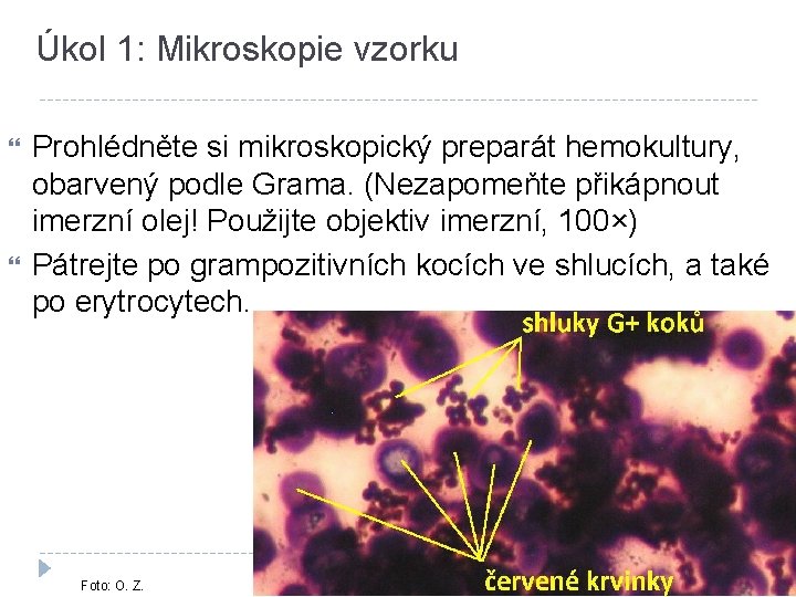 Úkol 1: Mikroskopie vzorku Prohlédněte si mikroskopický preparát hemokultury, obarvený podle Grama. (Nezapomeňte přikápnout