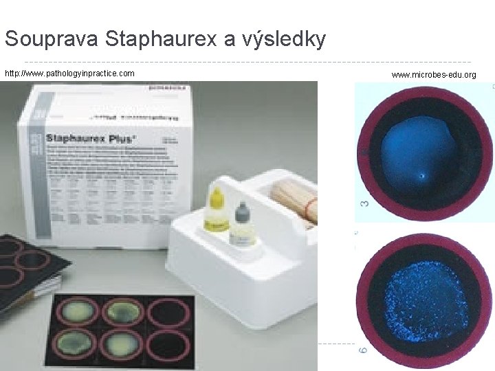 Souprava Staphaurex a výsledky http: //www. pathologyinpractice. com www. microbes-edu. org 
