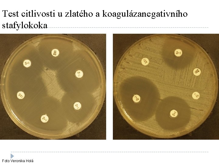 Test citlivosti u zlatého a koagulázanegativního stafylokoka Foto Veronika Holá 