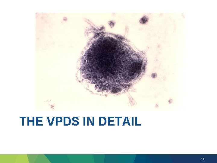 THE VPDS IN DETAIL 11 