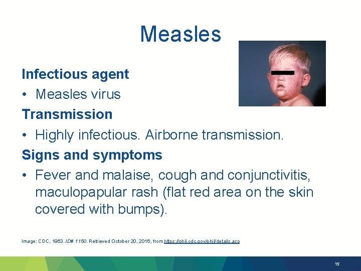 Measles Infectious agent • Measles virus Transmission • Highly infectious. Airborne transmission. Signs and