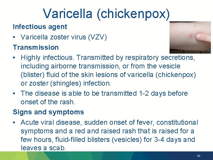 Varicella (chickenpox) Infectious agent • Varicella zoster virus (VZV) Transmission • Highly infectious. Transmitted