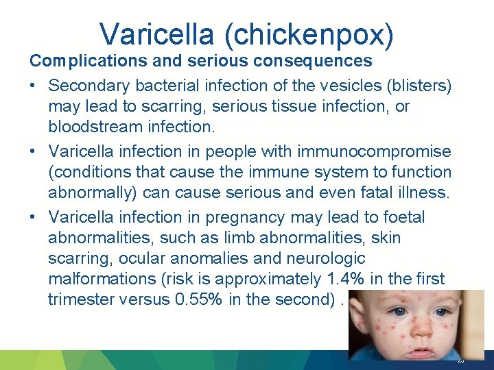 Varicella (chickenpox) Complications and serious consequences • Secondary bacterial infection of the vesicles (blisters)