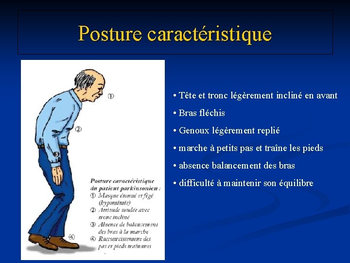 Posture caractéristique • Tête et tronc légèrement incliné en avant • Bras fléchis •